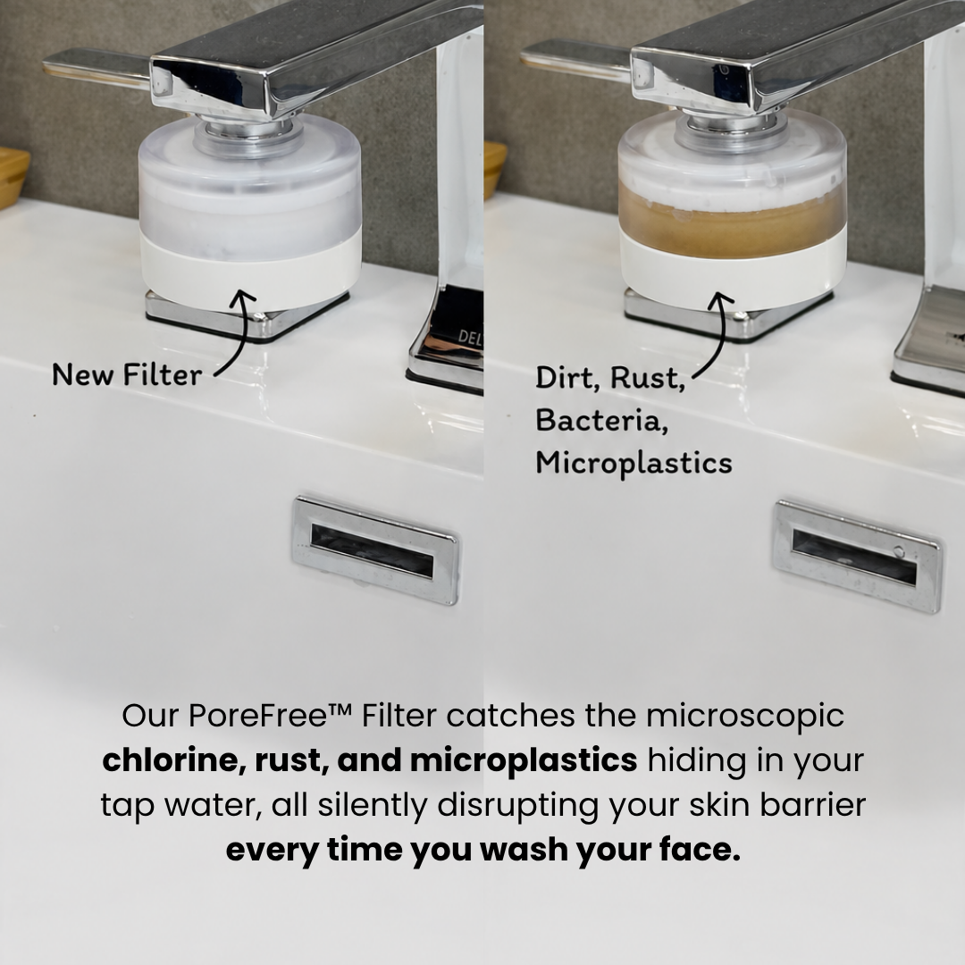 PoreFree™ Acne, Breakouts, Clear Skin Faucet Filter